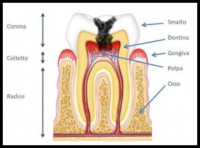 Anatomia del dente: corona, radice, smalto, dentina e polpa.